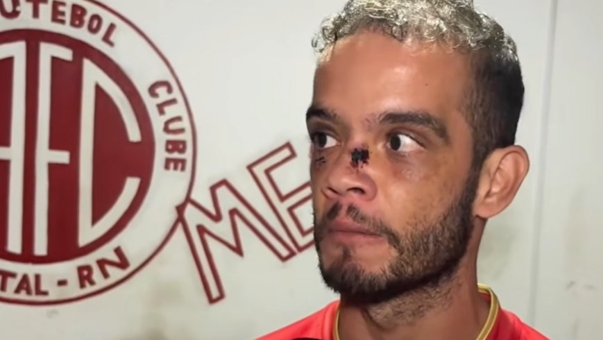 América-RN repudia violência e presta apoio a torcedor agredido após clássico